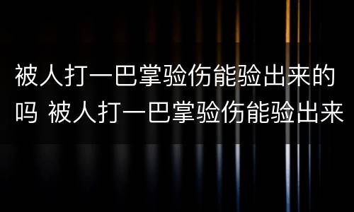 被人打一巴掌验伤能验出来的吗 被人打一巴掌验伤能验出来的吗